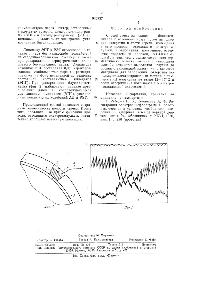 Способ съема импеданса и биопотенциалов с головного мозга (патент 940737)