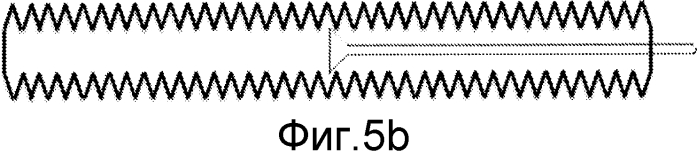 Катетерный набор для мочевого катетера (патент 2580984)