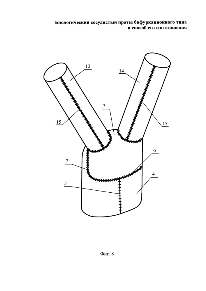 Биологический сосудистый протез бифуркационного типа и способ его изготовления (патент 2652870)