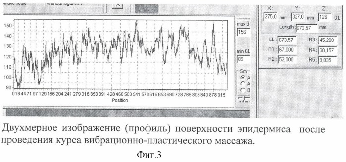 Способ коррекции инволюционных изменений кожи лица (патент 2379020)