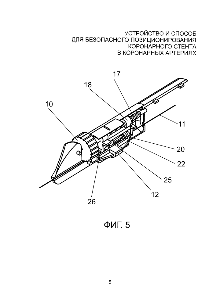 Устройство и способ для безопасного позиционирования коронарного стента в коронарных артериях (патент 2598798)