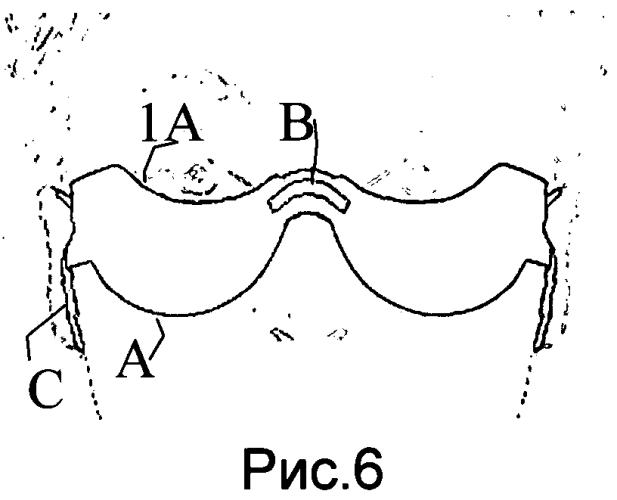 Щит-бабочка для ресниц (патент 2553568)
