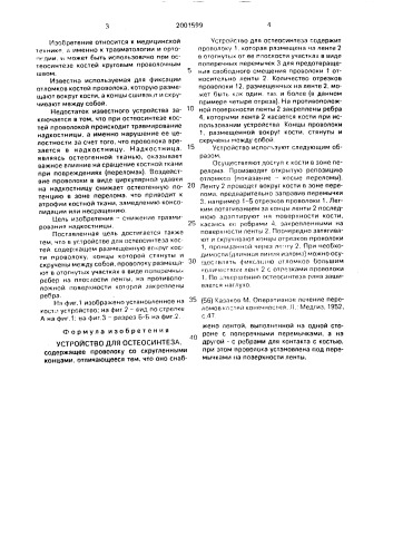 Устройство для остеосинтеза (патент 2001599)