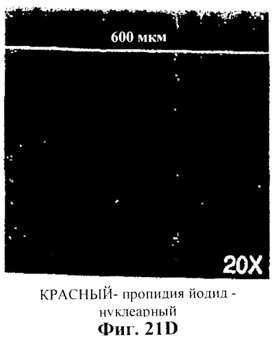 Захват эндотелиальных клеток-предшественников элюирующим лекарственные средства имплантируемым медицинским устройством (патент 2400256)