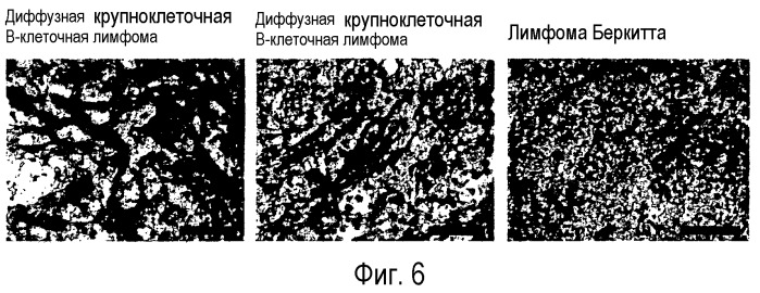 Комбинация слитого белка антитело против edb фибронектина-il-2 и молекулы, связывающейся с в-клетками, предшественниками в-клеток и/или их злокачественным аналогом (патент 2484845)