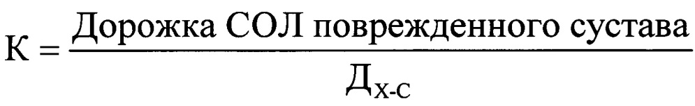 Способ оценки взаимодействия дефектов суставных поверхностей плечевого сустава при планировании хирургического лечения передней нестабильности (патент 2661717)