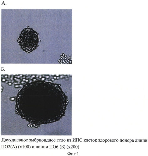 Способ получения пациент (донор)-специфических фибробластоподобных клеток из индуцированных плюрипотентных стволовых клеток человека (патент 2568059)