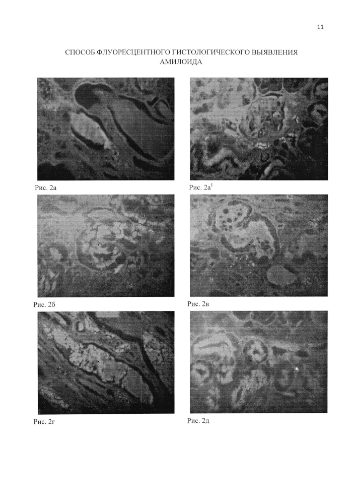 Способ флуоресцентного гистологического выявления амилоида (патент 2611408)