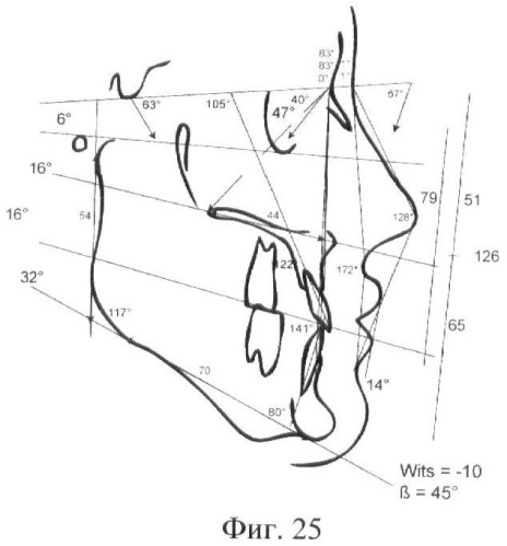 Способ объективной оценки результатов ортодонтического лечения (патент 2444292)
