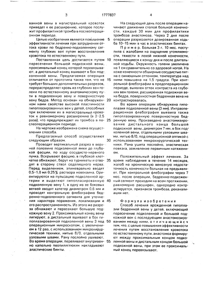 Способ лечения врожденной гипоплазин бедренной вены у детей (патент 1777837)