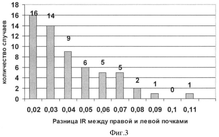 Способ оценки венозного кровотока по магистральным почечным венам (патент 2373856)