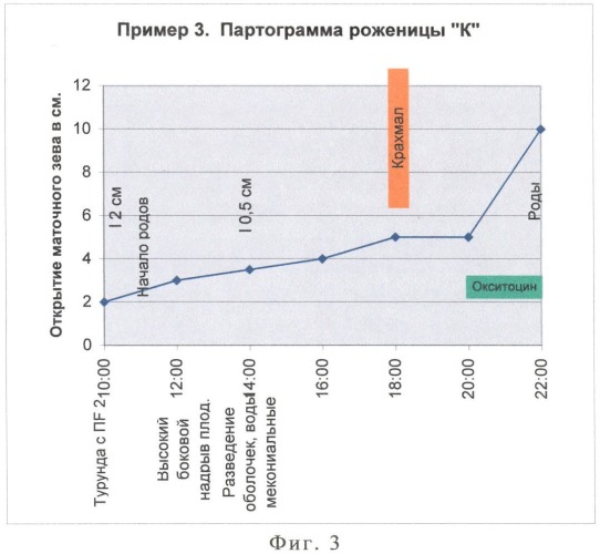 Способ лечения слабости родовой деятельности (патент 2407534)