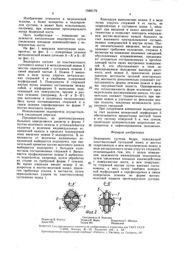 Эндопротез сустава бедер (патент 1560179)