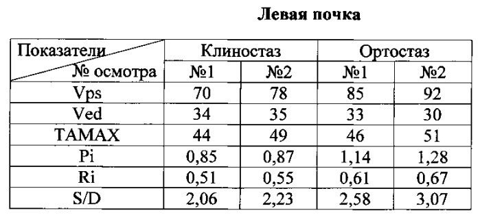 Способ ультразвуковой допплерографии при нефроптозе (патент 2571892)