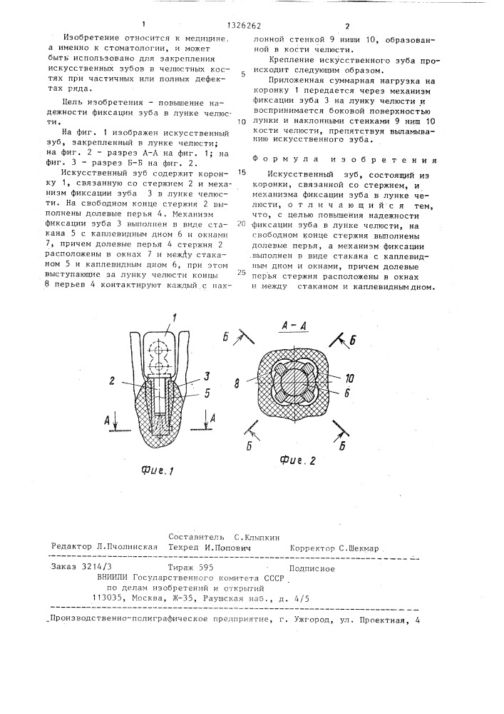 Искусственный зуб и.г.мухина (патент 1326262)