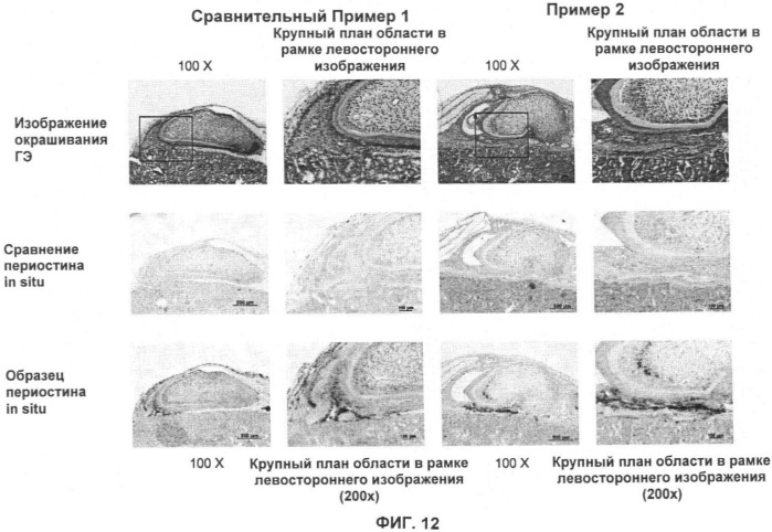 Способ формирования зуба, зубной ряд и способ формирования ткани (патент 2428140)