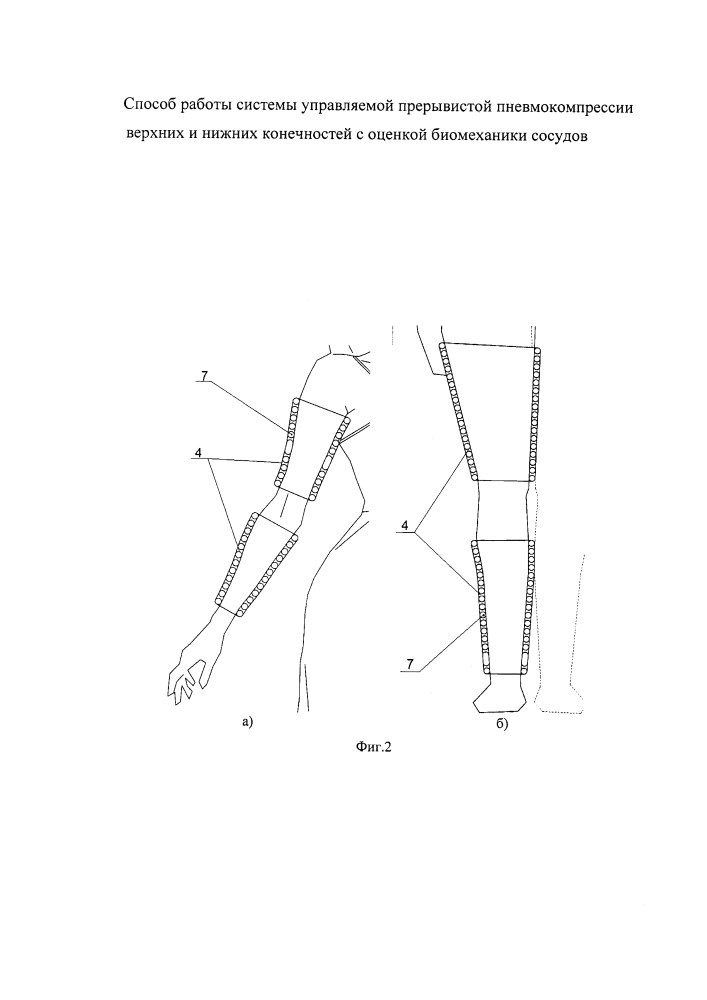 Способ работы системы управляемой прерывистой пневмокомпрессии верхних и нижних конечностей с оценкой биомеханики сосудов (патент 2644927)