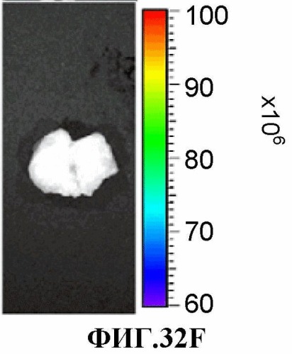 Конъюгаты rgd-(бактерио)хлорофилл для фотодинамической терапии и визуализации некротических опухолей (патент 2518296)
