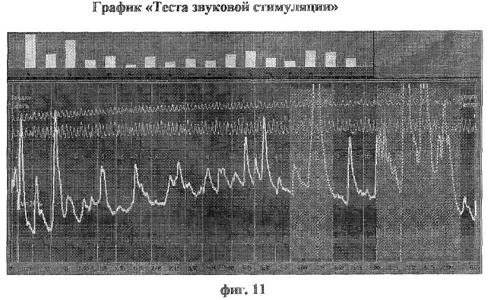 Способ диагностики нарушений сексуальных предпочтений (патент 2283029)