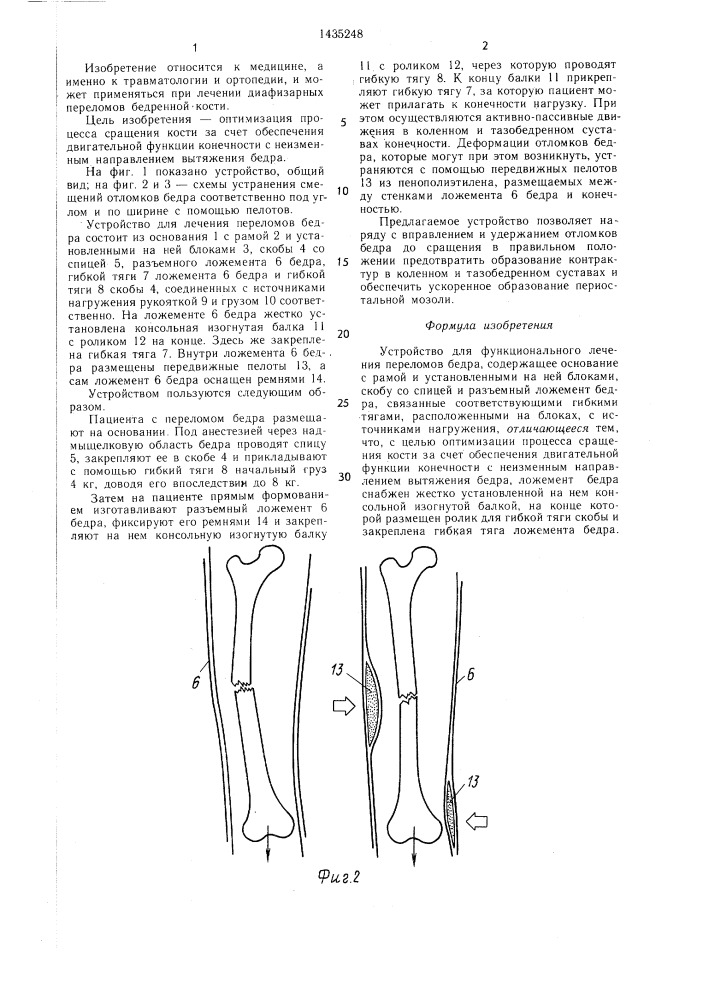 Устройство для функционального лечения переломов бедра (патент 1435248)