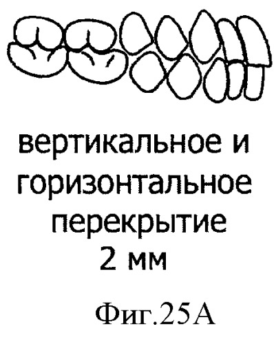 Зубные протезы, зубные дуги и способы их изготовления (патент 2510252)