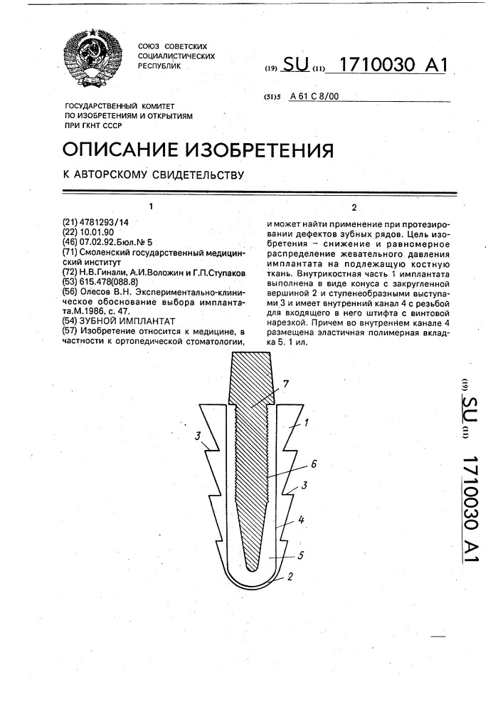 Зубной имплантат (патент 1710030)