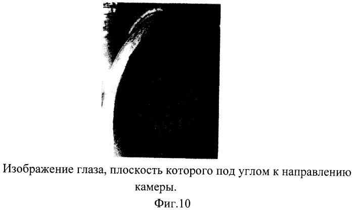 Способ контроля сердечно-легочной реанимации и устройство для его осуществления (патент 2549314)