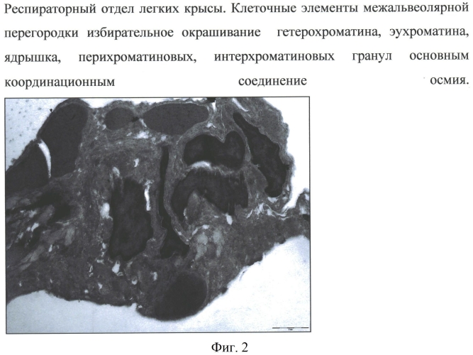 Способ дополнительного электронноплотного контрастирования нуклеиновых кислот в ядре и цитоплазме при гистохимическом выявлении катионов натрия в ультраструктурах клеток и тканей (патент 2557931)