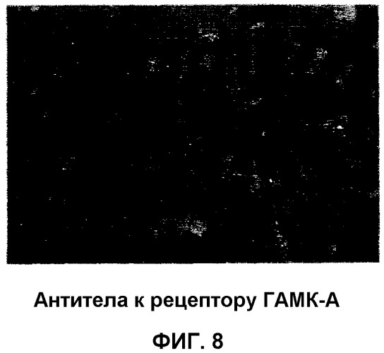 Получение гамкергических нейронов in vitro из эмбриональных стволовых клеток и их применение при лечении неврологических расстройств (патент 2380410)