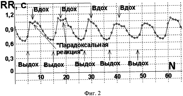 Способ коррекции функционального состояния человека (патент 2323681)