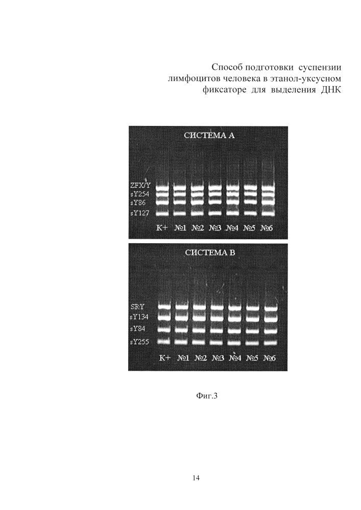 Способ подготовки суспензии лимфоцитов человека в этанол-уксусном фиксаторе для выделения днк (патент 2595816)