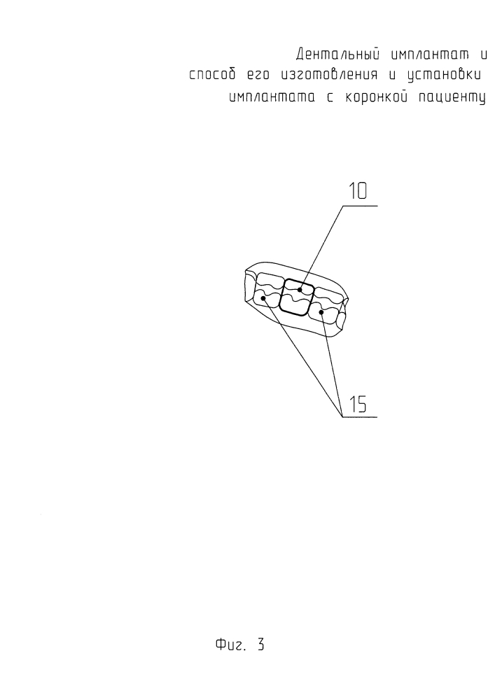 Дентальный имплантат и способ его изготовления (патент 2624169)