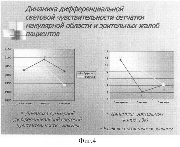 Способ модифицированной субпороговой панмакулярной микрофотокоагуляции сетчатки при диабетическом макулярном отёке (патент 2308920)