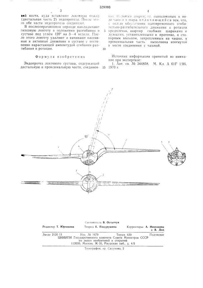 Эндопротез локтевого сустава (патент 528093)