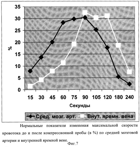 Способ диагностики ауторегуляции сосудов головного мозга (патент 2311133)