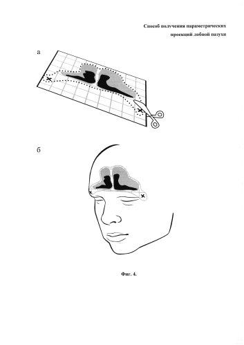 Способ определения параметров лобных пазух (патент 2590868)