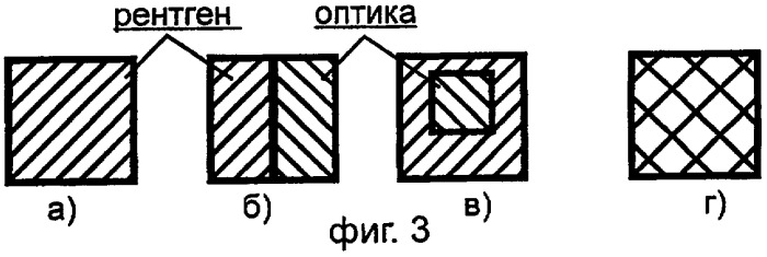 Рентгенооптический эндоскоп (патент 2387979)