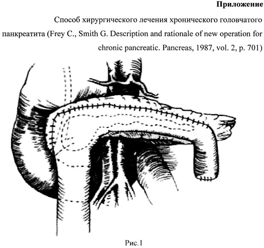 Хирургическое лечение хронического панкреатита. Хирургические методы лечения хронического панкреатита. Операции при хроническом панкреатите. Дренирующие операции при хроническом панкреатите. Головчатый панкреатит.