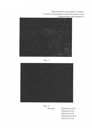 Способ патоморфологической диагностики хронического аппендицита (патент 2582280)
