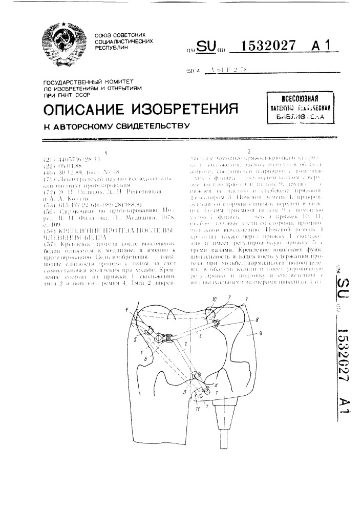 Крепление протеза после вычленения бедра (патент 1532027)
