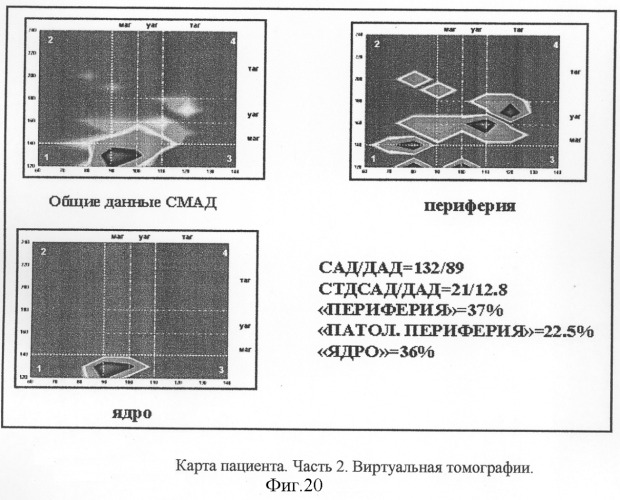 Способ графического отображения данных суточного мониторирования артериального давления, способ диагностического обследования больного аг, способ выбора тактики лечения больного аг и оценки эффективности лечения больного аг по вл. в. шкарину (патент 2301013)