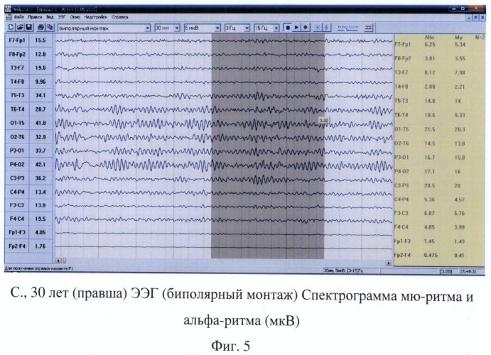 Способ диагностики функциональной межполушарной асимметрии у правшей и левшей (патент 2483672)