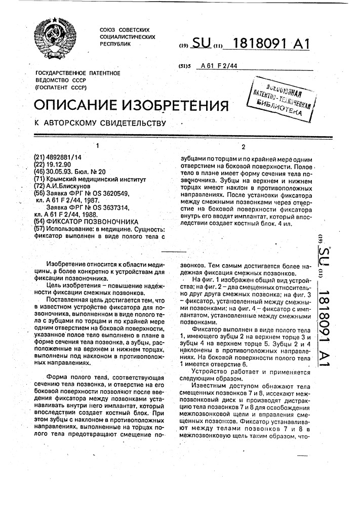 Фиксатор позвоночника (патент 1818091)