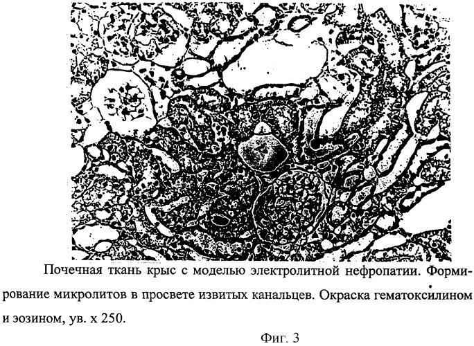 Способ моделирования электролитной нефропатии у крыс (патент 2256953)