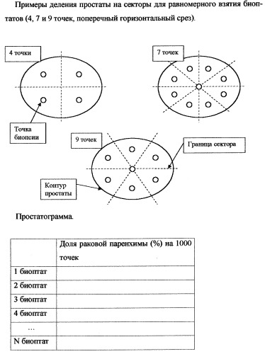 Способ определения объема раковой паренхимы в простате (патент 2258466)