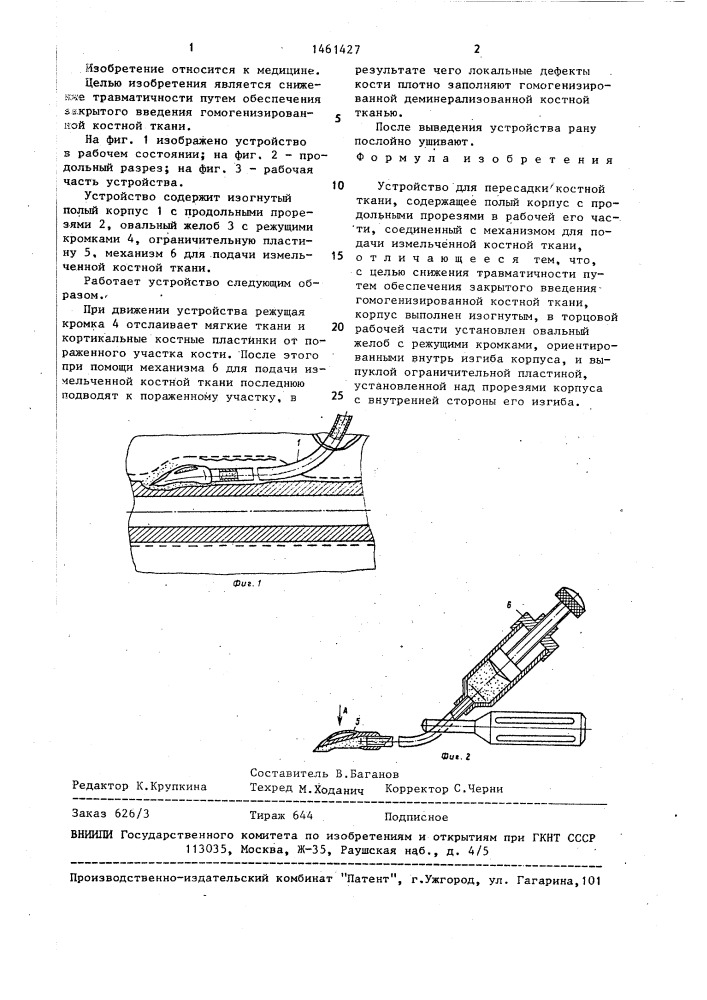 Устройство для пересадки костной ткани (патент 1461427)