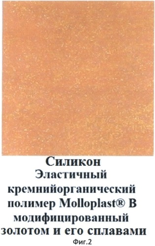 Способ модификации базисных материалов из акриловых пластмасс или силиконов для съемных зубных протезов, обтураторов и компонентов челюстно-лицевых протезов золотом и золотыми сплавами (патент 2510251)