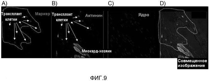 Способ конструирования массы миокардиальных клеток и применение массы миокардиальных клеток (патент 2467066)