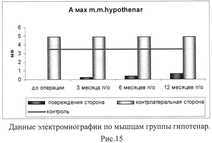 Кодон-оптимизированная рекомбинантная плазмида, способ стимуляции регенерации периферического нерва, способ лечения поврежденного нерва человека (патент 2558294)