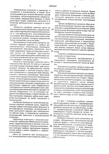 Назубная съемная шина (патент 2003292)